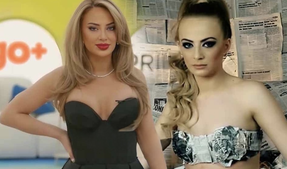 Transformimi i Suanitës: si dukej para dhe pas ndërhyrjeve estetike